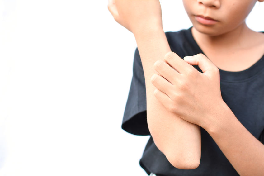 Psoriasis guttata – a special form of psoriasis in children